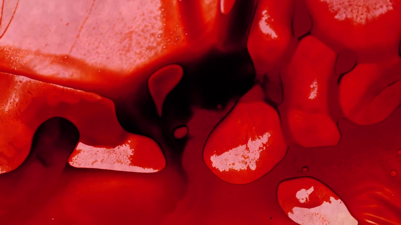 Stock Video Infected Blood Under A Microscope Animated Wallpaper - Free Download
