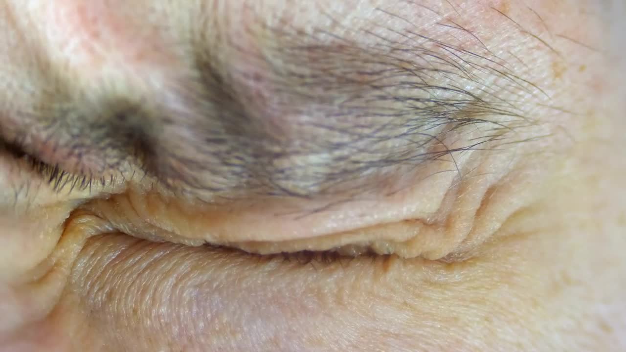 Stock Video Crazy And Fear Look On A Human Eye Close Up Live Wallpaper For PC - Free Download