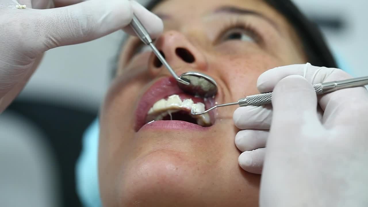 Stock Video Dentist Hands Cleaning Teeth Before Surgery Live Wallpaper For PC - Free Download