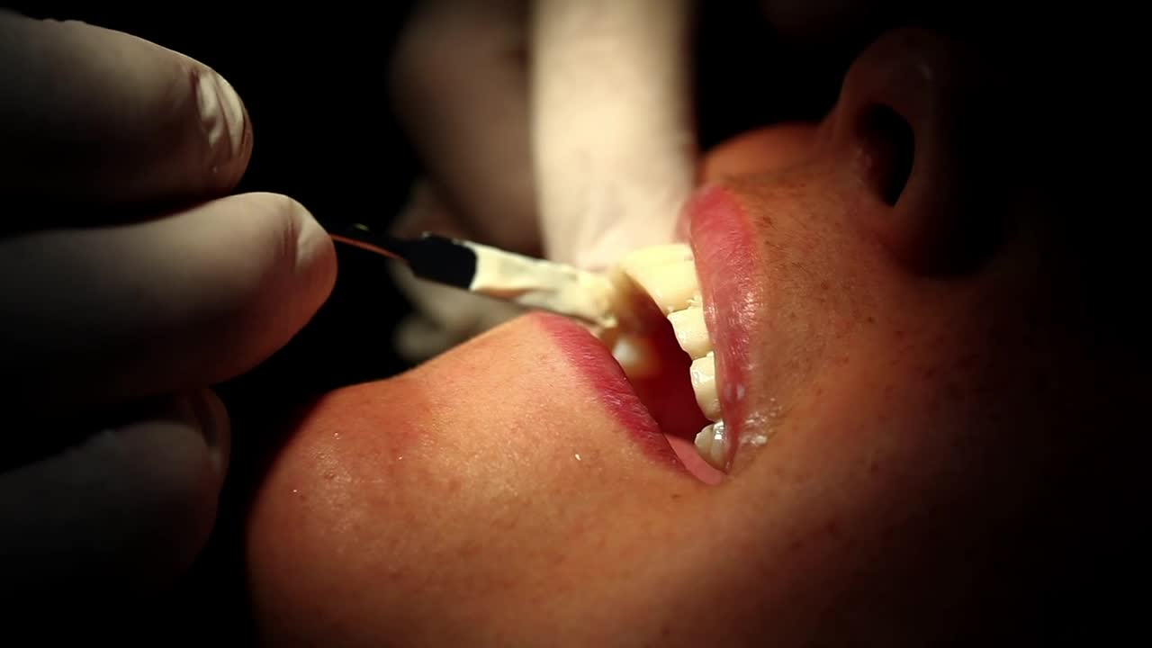 Stock Video Dental Surgery Close Up Live Wallpaper For PC - Free Download