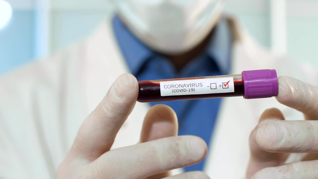 Stock Video Doctor Holding A Blood Sample With Coronavirus Live Wallpaper For PC - Free Download