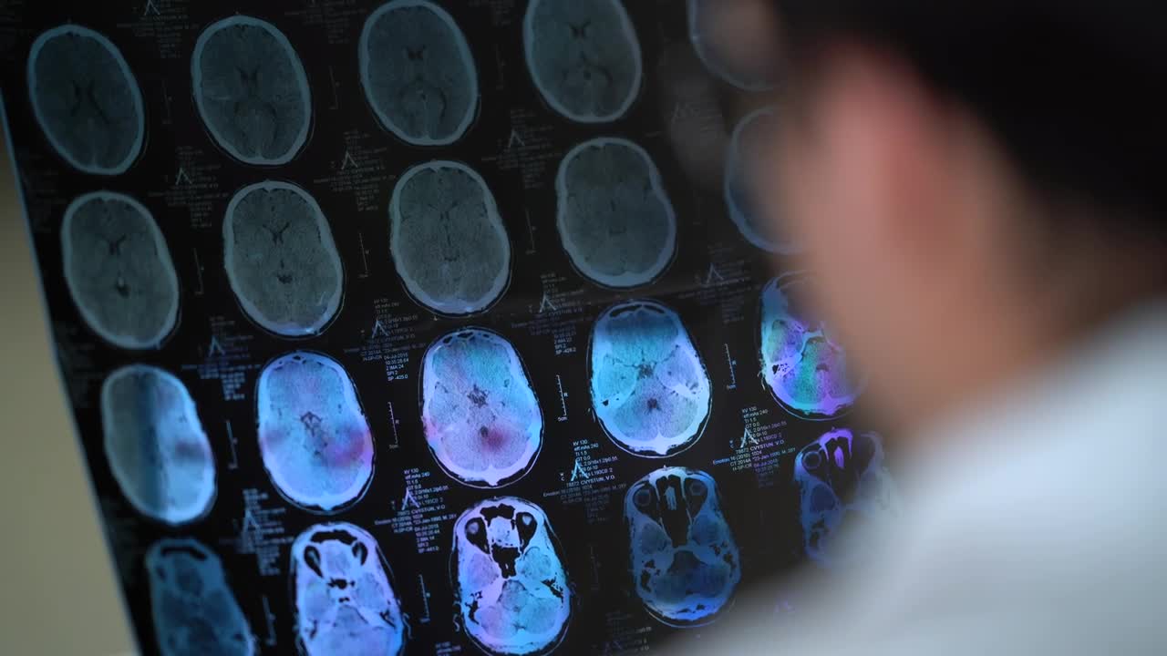 Stock Video Doctor Analyzing A Skull Tomography Live Wallpaper For PC - Free Download