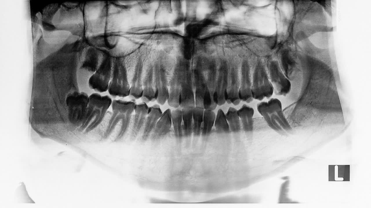 Stock Video Dental X Ray Live Wallpaper For PC - Free Download
