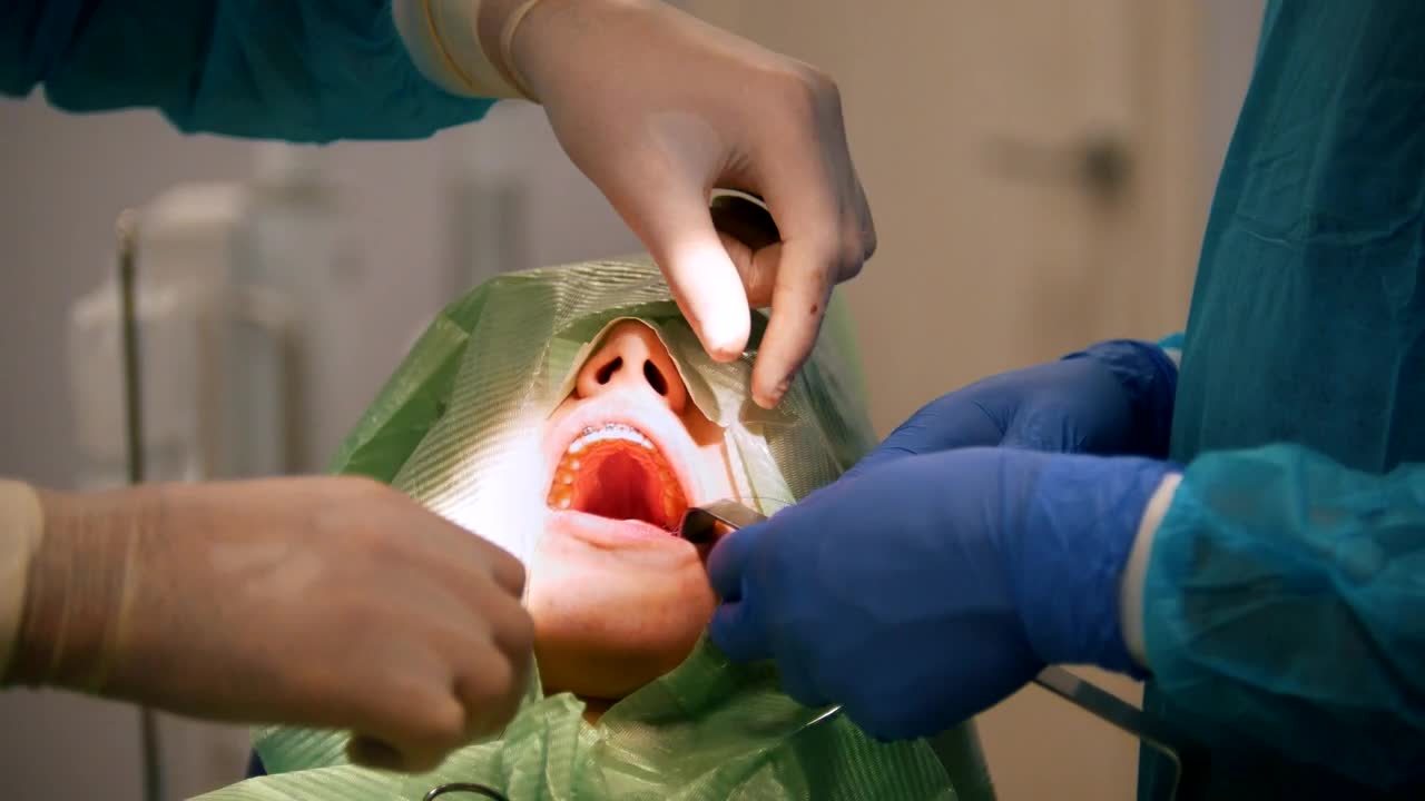 Free Video Stock surgeons working on a patients mouth Live Wallpaper - Free Download