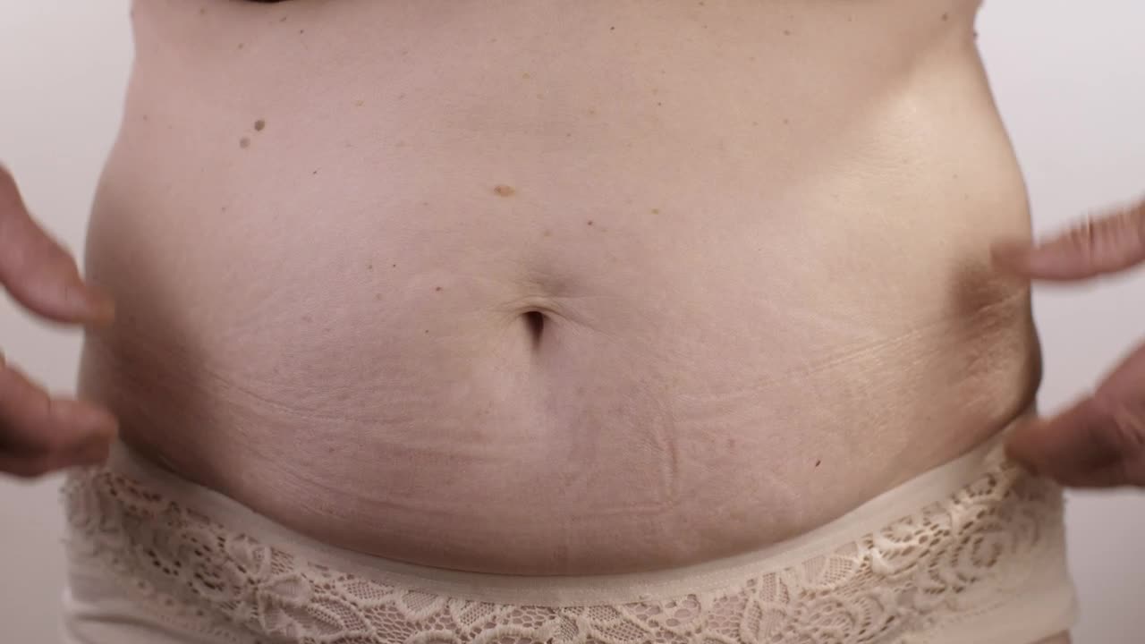 Stock Video Obese Person Touching His Stomach Live Wallpaper - Free Download