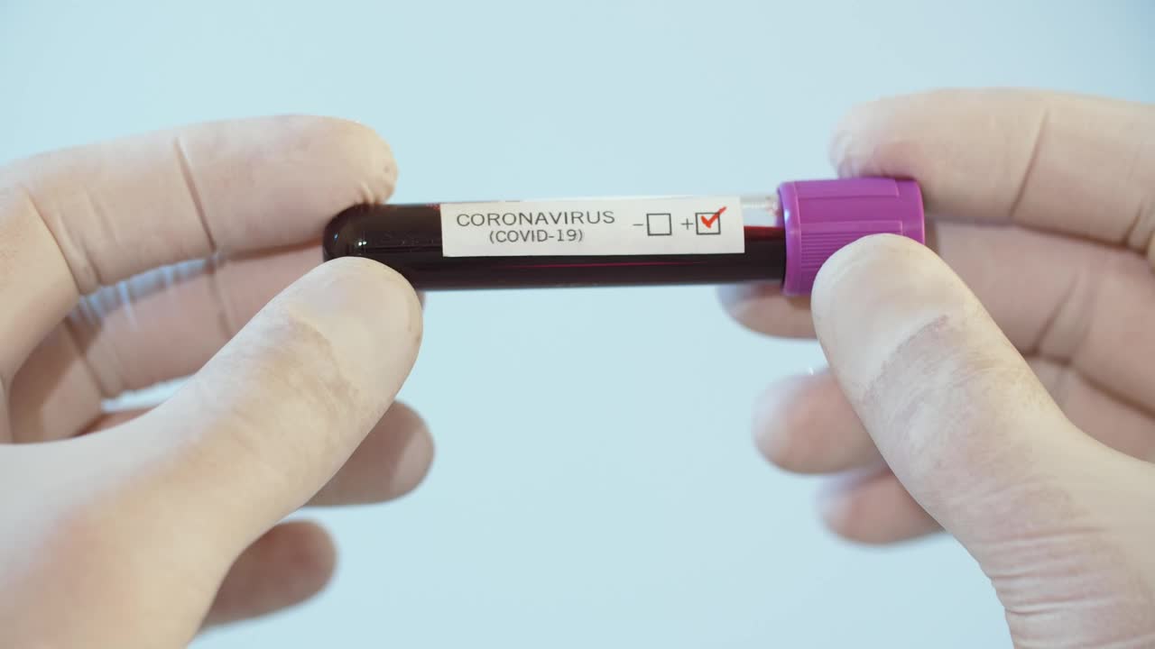 Stock Video Covid  Test In A Lab Tube Live Wallpaper For PC - Free Download