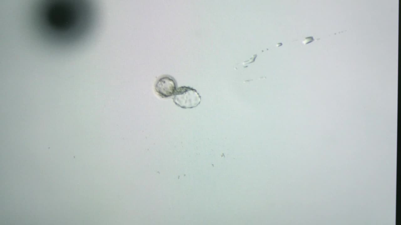 Stock Video Embryo Under A Microscope View Live Wallpaper For PC - Free Download