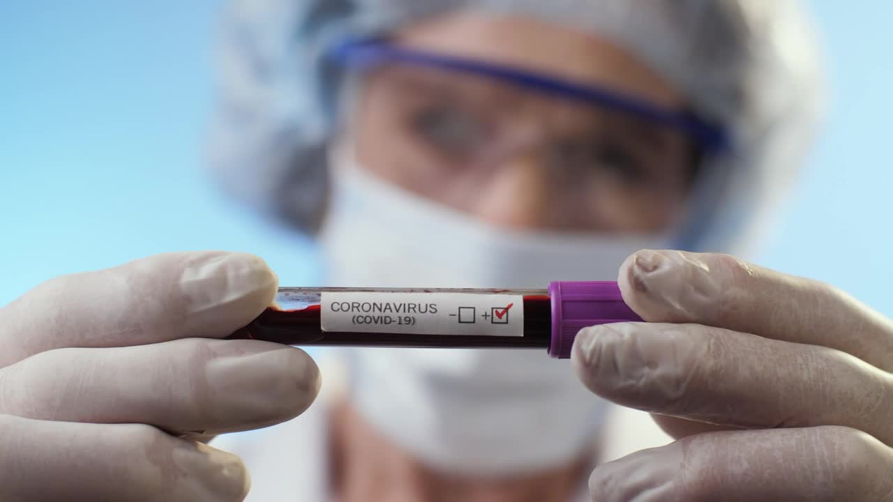Video Stock Positive Coronavirus Test Results Live Wallpaper Free - Free Download