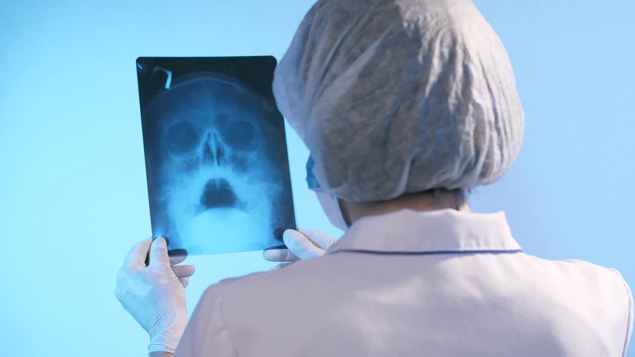 Stock Video Female Doctor Looking At The X Ray Of A Skull Live Wallpaper For PC - Free Download
