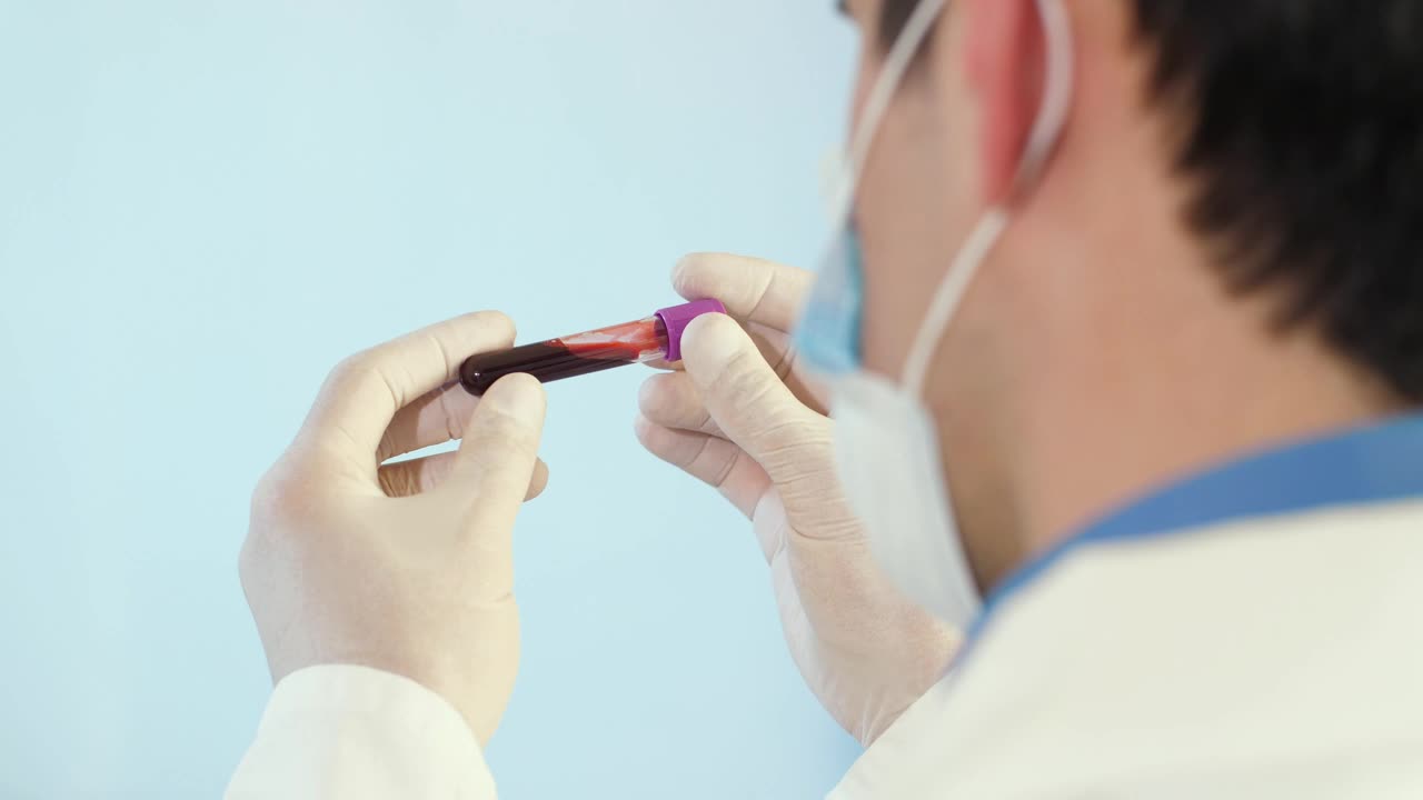 Stock Video Doctor Checking A Coronavirus Test Over Shoulder Live Wallpaper For PC - Free Download