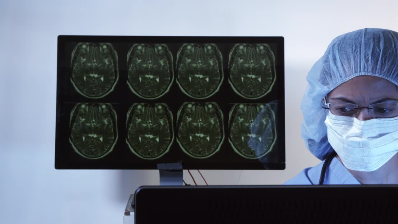 Stock Video Doctor Reviewing Scan Results Live Wallpaper For PC - Free Download