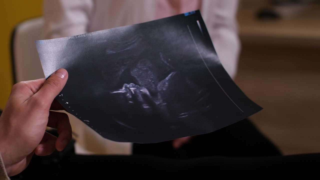 Stock Video Parents Holding An Ultrasound Photo Live Wallpaper - Free Download