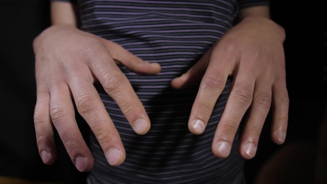 Stock Video Parkinsons Sick Person Live Wallpaper - Free Download