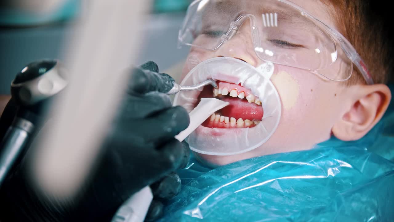 Stock Video Dentist Fixing A Childs Teeth Live Wallpaper For PC - Free Download