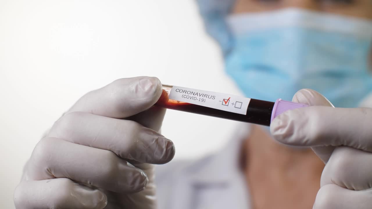 Stock Video Doctor Holding A Covid  Blood Test Live Wallpaper For PC - Free Download