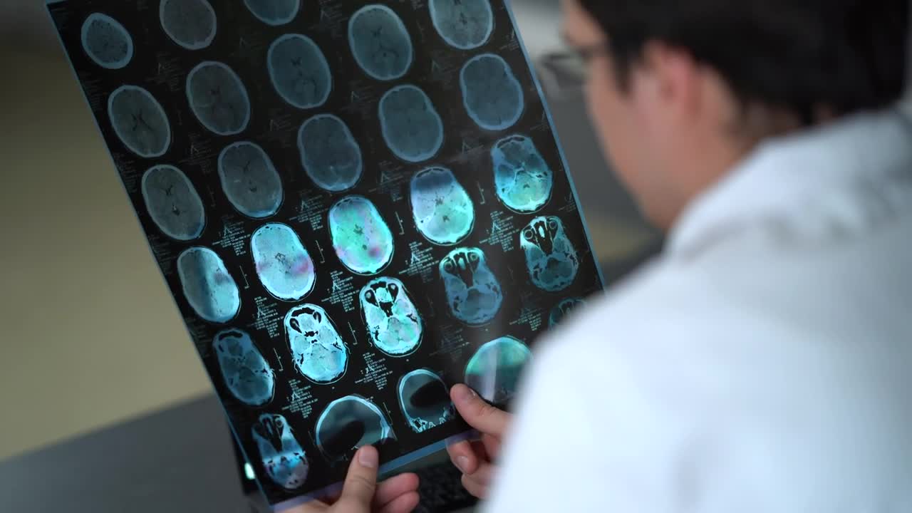 Stock Video Doctor Looking At An X Ray Of The Skull Live Wallpaper For PC - Free Download