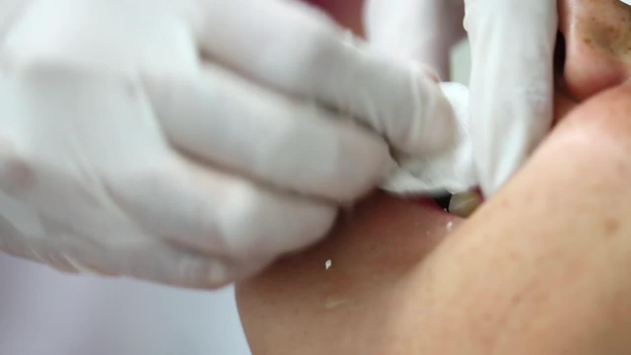 Stock Video Dentist Hands Preparing A Patient Live Wallpaper For PC - Free Download