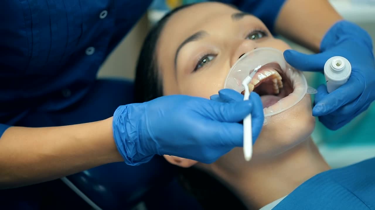 Stock Video Dentist Hands Cleaning Teeth To A Patient Live Wallpaper For PC - Free Download