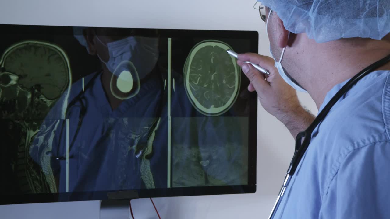 Stock Video Doctor Reviewing A Brain Scan Live Wallpaper For PC - Free Download