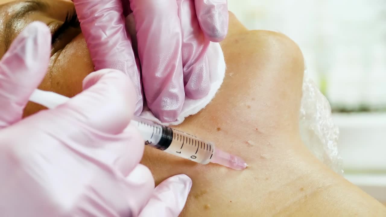 Stock Video Cosmetologist Making Face Lifting Injections Live Wallpaper For PC - Free Download